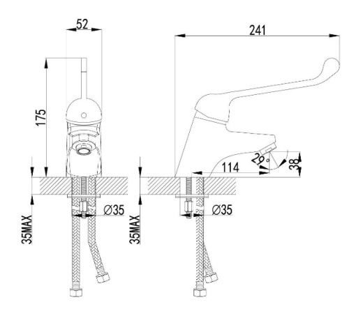 Смеситель для раковины Globo Ausilia DS142